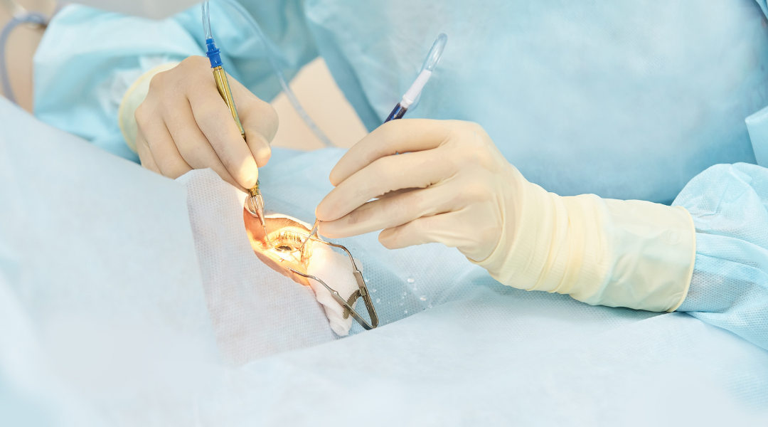 Cirugia de Retina